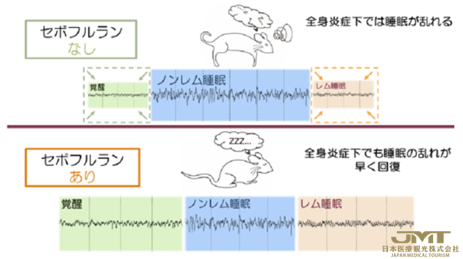 JMT日本医疗——吸入式麻醉可以改善全身炎症时的睡眠周期②