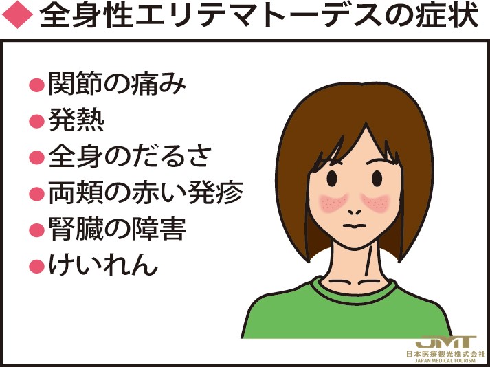 JMT日本医疗——药物种类增加，治疗演变 ，许多年轻女性患有的系统性红斑狼疮