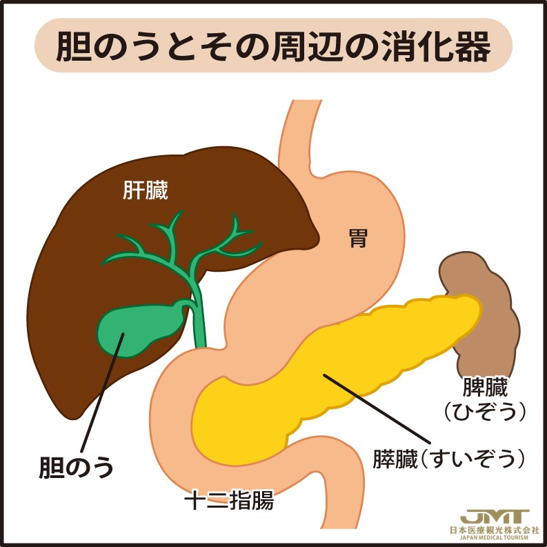 JMT日本医疗——大多数是无症状的胆囊结石，也有癌变的风险